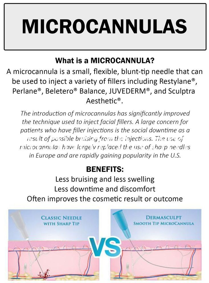 microcannulas microcannulas
